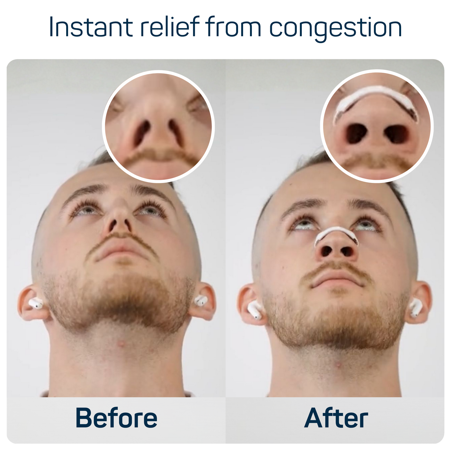 Aeris Starter Kit™