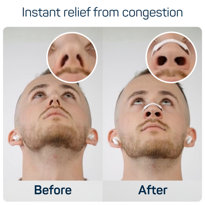 Aeris Starter Kit™